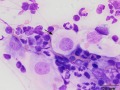 Mycoplasma
