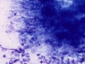 Actinomyces