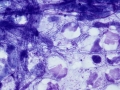 Actinomyces
