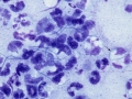Actinomyces