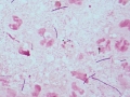 Actinomyces