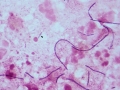 Actinomyces