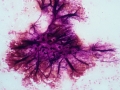 Actinomyces