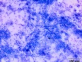 Aspergillus