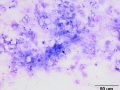 Aspergillus