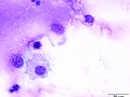 Streptococcus zooepidemicus & fungal spore