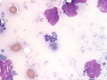 Leishmania