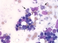 Leishmania
