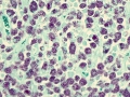 Mycobacteria (Ziehl-Neelson)