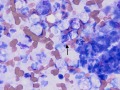 Listeria (cat)