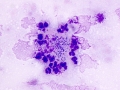 Actinobacillus