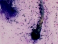 Aspergillus