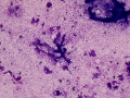 Aspergillus