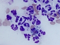 Staphylococcus