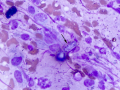 Blastomyces (mycelial form, DQ)