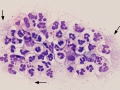 Borrelia
