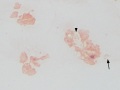 Brucella