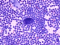 Protozoa