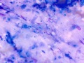 Candida