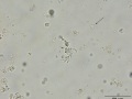 Streptococcus epidermidis