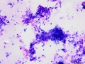 Streptococcus epidermidis