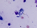 Suspect kerion with fungal conidia (dog)