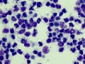 Corynebacterium pseudotuberculosis