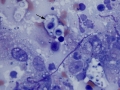 Cryptococcus