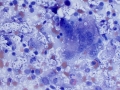 Cryptococcus