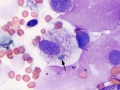 Dematiaceous fungal spore