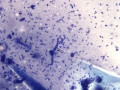 Dermatophilus