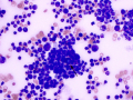 Blastomyces (WG)