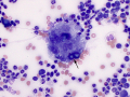 Blastomyces  (WG)