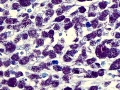 Mycobacteria (Fite-Faraco)