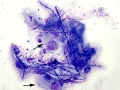 Aspergillus