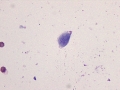 Giardia (urine)