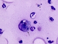 Rhodococcus