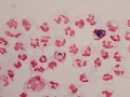 Rhodococcus (gram)