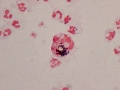 Rhodococcus (gram)