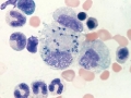 Leishmania