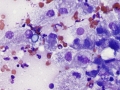 Blastomyces