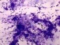Lungworm (goat)