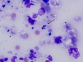 Micrococcus