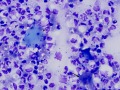 Micrococcus