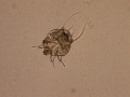 Sarcoptes