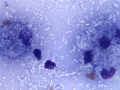 Mycobacteria