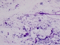 Mixed fecal flora (post treatment)