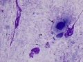 Mixed fecal flora (pre treatment, dog)