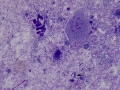Mixed fecal flora (pre treatment)