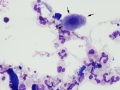 Mycoplasma